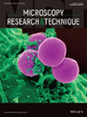 Microscopy Research And Technique雜志